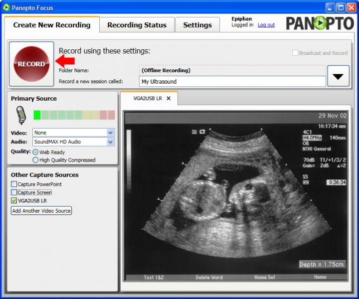 用VGA2USB LR和PanoptoFocus软件捕获记录和分享医学图